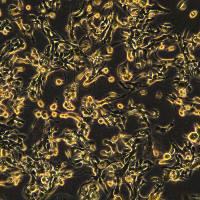 乳腺癌细胞 MFM223