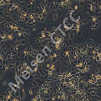 人卵巢癌细胞 UWB1.289