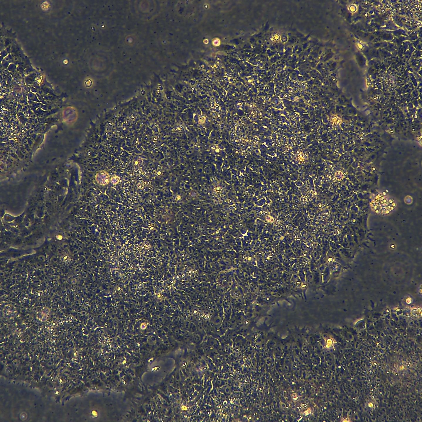 皮肤来源的IPS hiPSC-F1