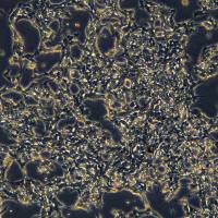 脑神经母细胞瘤 KP-N-YN