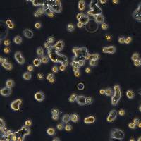 结肠癌细胞细胞 COLO678