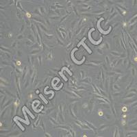 人脑恶性神经胶质母细胞瘤 M059J