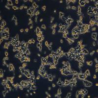 结肠癌细胞细胞 GP2d