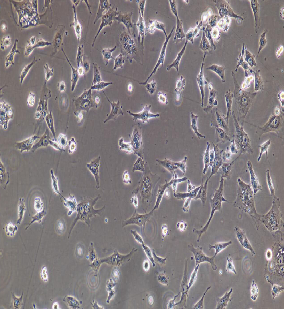 NCI-H1694人小细胞肺癌