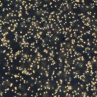 弥漫大B细胞淋巴瘤 U2932