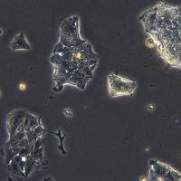 人肺鳞癌细胞 NCI-H2170