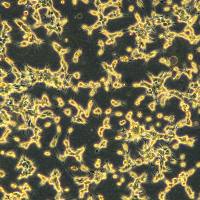 人前列腺癌细胞  Lncap