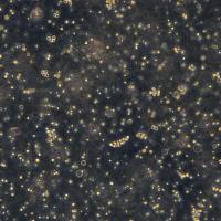 人急性T淋巴细胞白血病细胞 MOLT-3