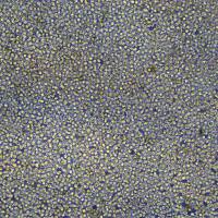 人胃癌细胞 SNU-620