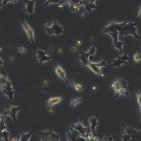 浙江美森-人前列腺癌细胞 22Rv1