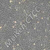 肾脏基因编辑小鼠自发肿瘤永生化细胞 Tfe301-m/SV40T 货号