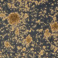 恶性非霍奇金淋巴瘤患者的自然杀伤细胞 NK92MI