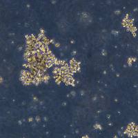 浙江美森-人神经内分泌前列腺癌细胞 NCI-H660