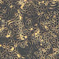 人卵巢癌细胞 OVISE