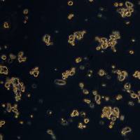 非小细胞肺癌细胞NCI-H810