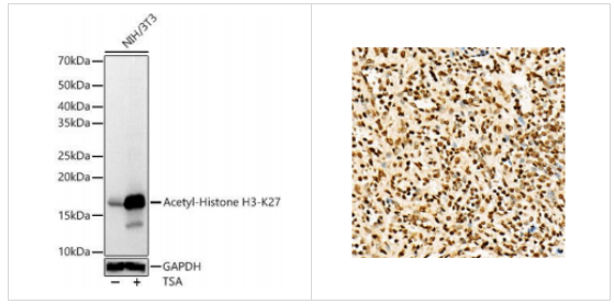 Epigentek组蛋白H3K27ac（乙酰化H3K27）多克隆抗体，促销倒计时开始！