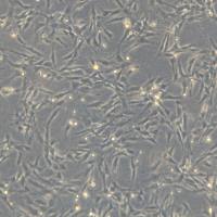 永生化人源胚胎脑血管周细胞