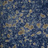 弥漫性大B细胞淋巴瘤 SU-DHL-5