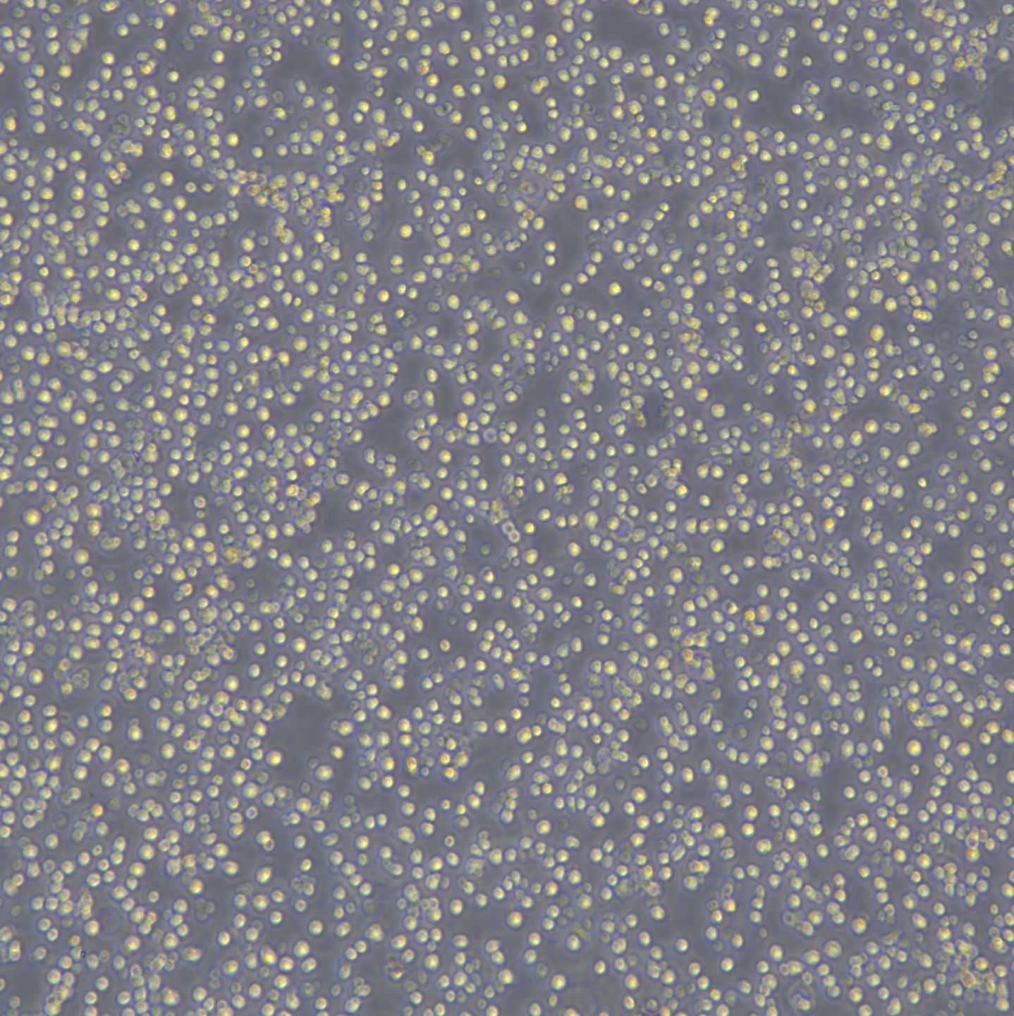 人B淋巴瘤细胞 RC