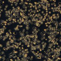 浙江（杭州）美森 人肝癌细胞 SNU-398