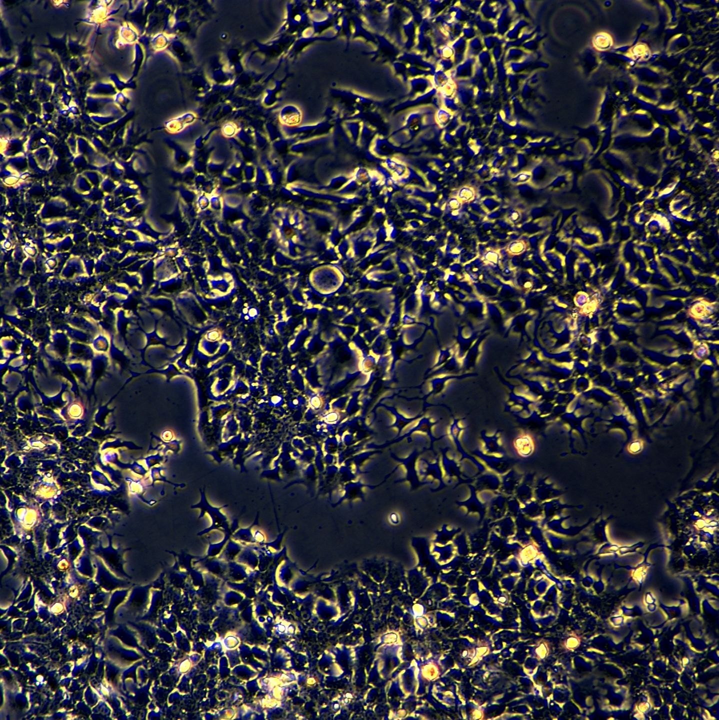 人食道癌肿瘤细胞 TE10