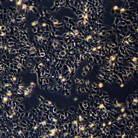 人食道癌肿瘤细胞 TE10