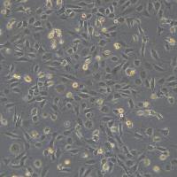 永生化小鼠胚胎心外膜细胞 MEC1