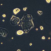 结肠癌细胞 CL-40