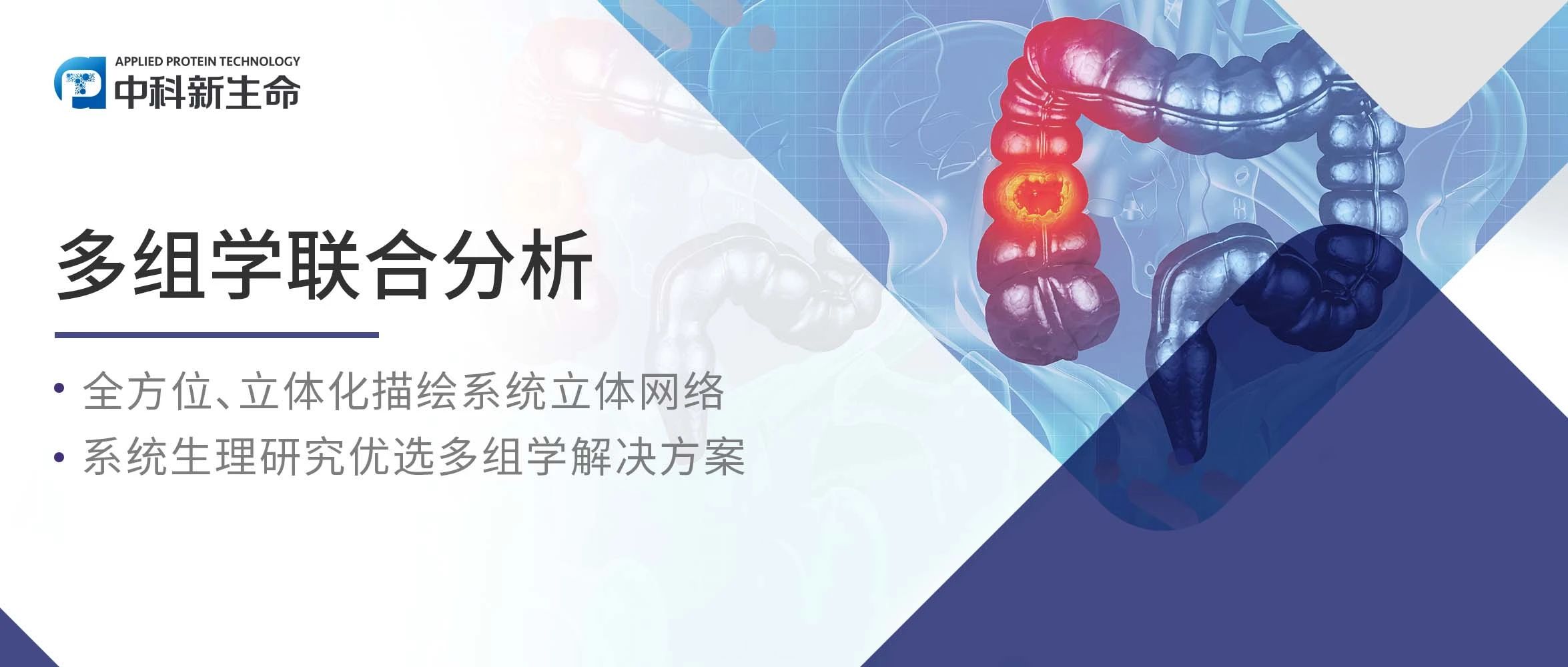 Nat Commun | 环境因素竟是克罗恩病的‘隐形推手’？中山一院队列研究发现：咖啡、维生素D或能降低风险