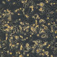 人乳腺癌细胞 MDA-MB-436(Luc2)