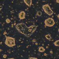 人结肠癌细胞 T84