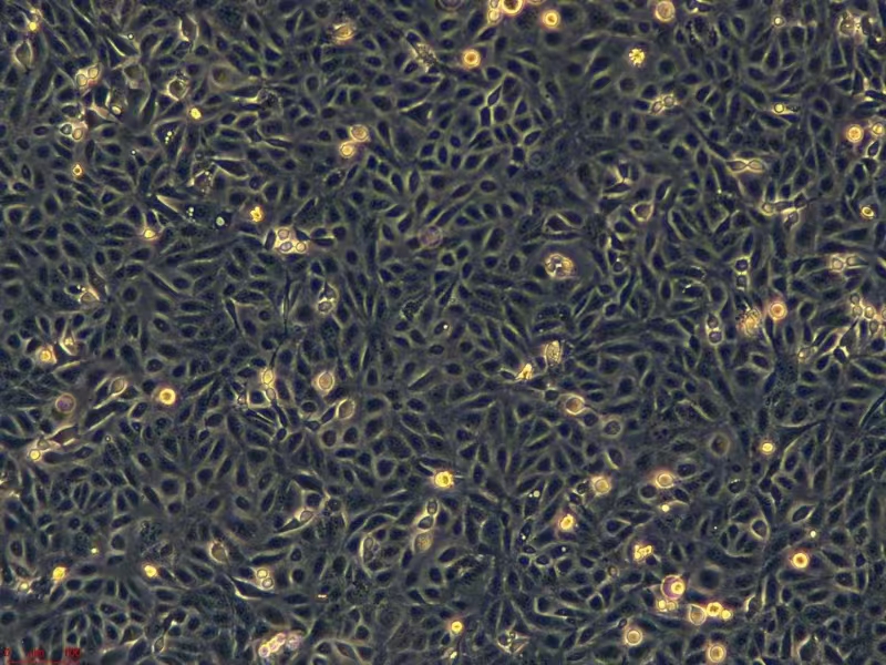 浙江（杭州）美森 人胃黏膜上皮细胞 GES-1