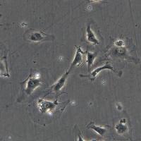 淋巴管内皮细胞 CTCC-129-HUM