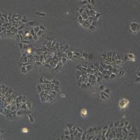 人非小细胞肺癌细胞 HCC827