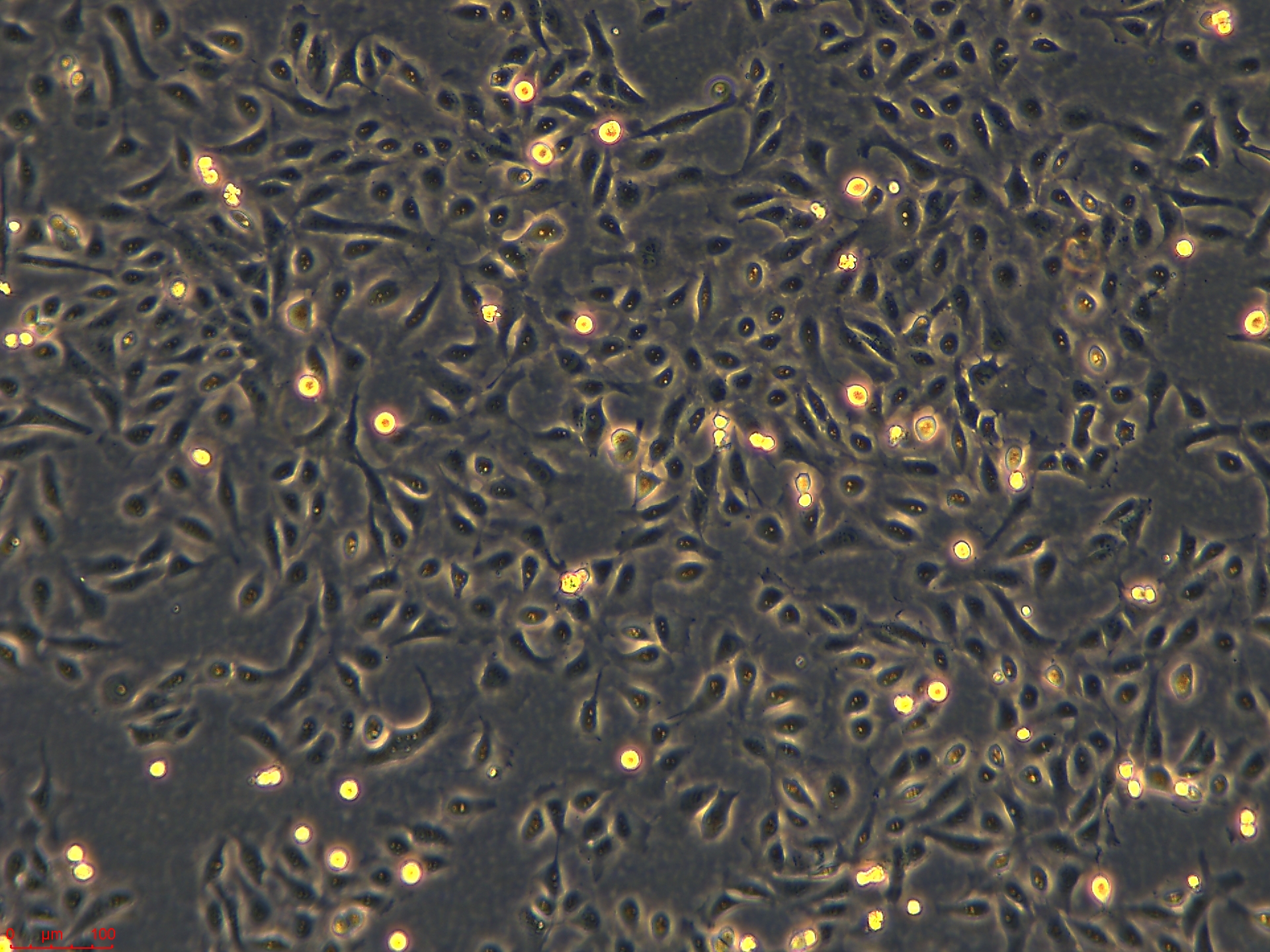 浙江（杭州）美森 人胃黏膜上皮细胞 GES-1