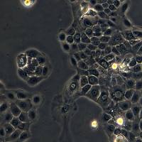 人舌鳞状细胞癌 BICR3