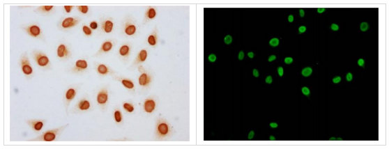 组蛋白H4K79ac（乙酰化 H4K79）多克隆抗体，低至冰点价！