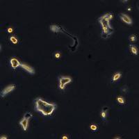 人前列腺癌细胞 VCaP