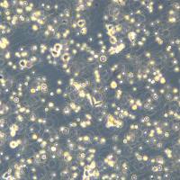 人低分化肺腺癌细胞 SK-LU-1