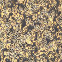 小细胞肺癌细胞 SBC-5