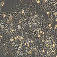 人卵巢癌细胞 UWB1.289+BRCA1