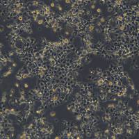 人食道癌肿瘤细胞 KYSE180