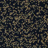 非霍奇金淋巴瘤 Karpas422