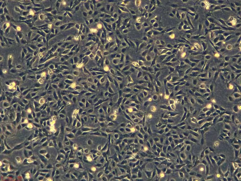 浙江（杭州）美森 人胃黏膜上皮细胞 GES-1