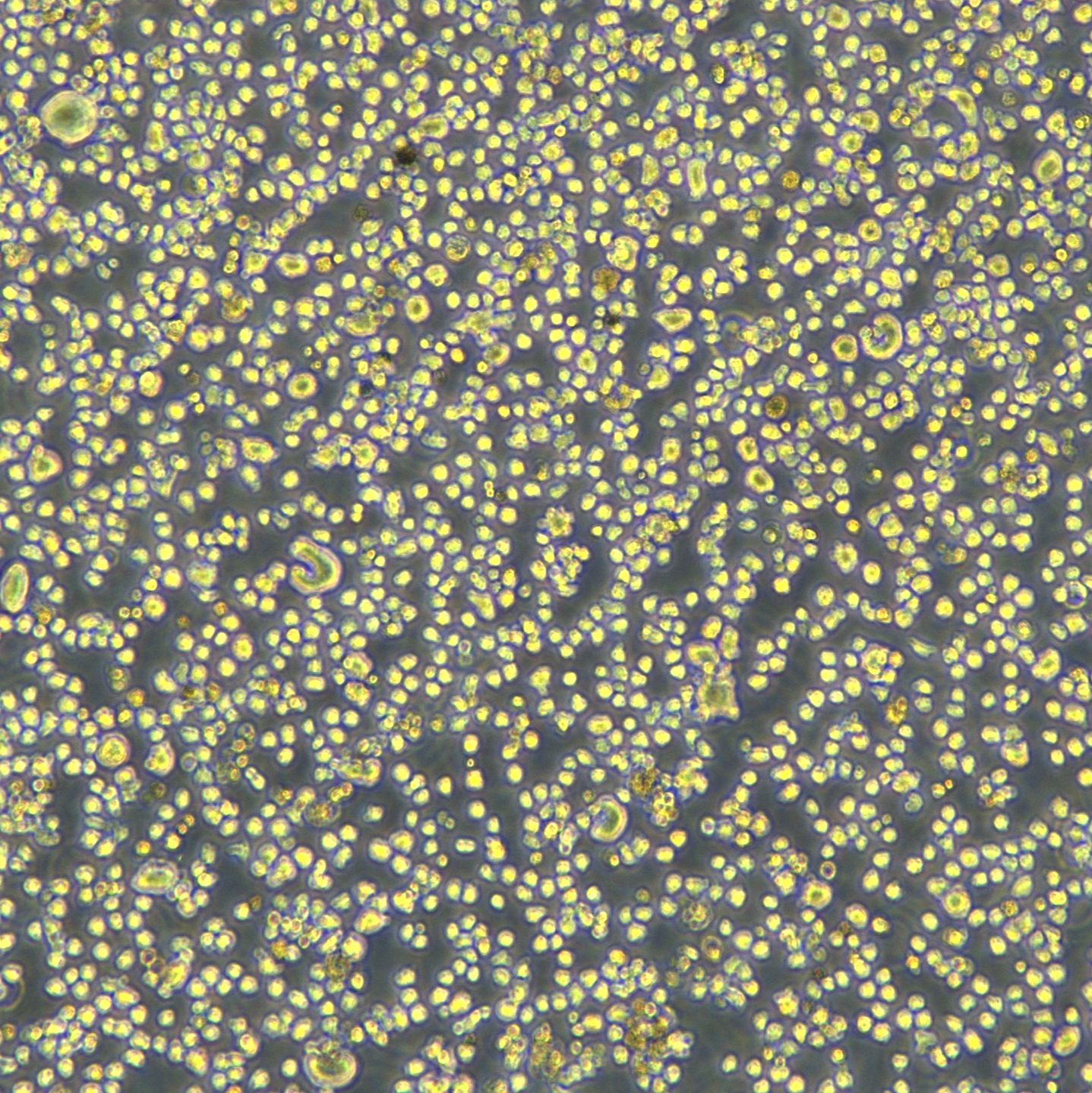 人多发性骨髓瘤细胞 OPM-2