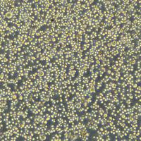 人多发性骨髓瘤细胞 OPM-2