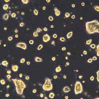 人结肠腺癌细胞 LS 174T