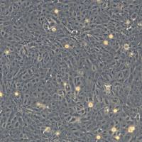 浙江美森-人原代皮脂腺细胞