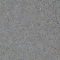 人多发性骨髓瘤细胞 KMS-12-PE