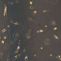 人肺成纤维细胞-特发性肺纤维化 LL 97A (AlMy)